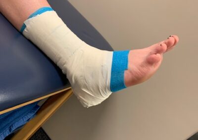 Ankle taping by Rexburg Rehabilitation